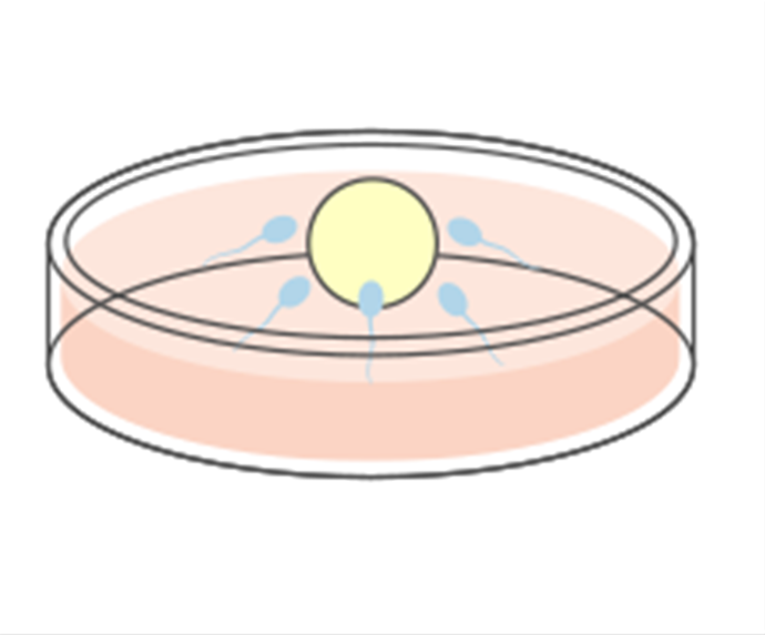 体外受精とは?